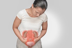 שתן עכור - תמונת אווירה