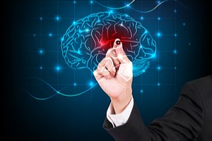 פרדקסה - תמונת המחשה