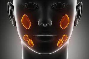 נפיחות מתחת לעצם הלסת - תמונת המחשה