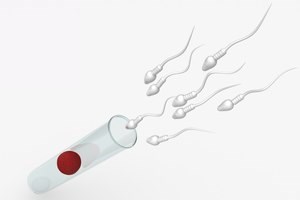 בדיקת זרע: אבחון בעיית פריון-תמונה