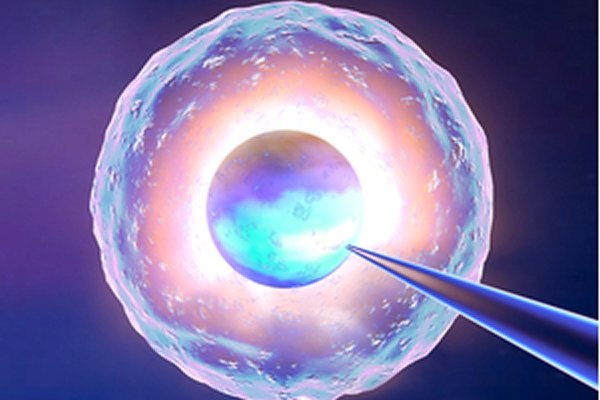 כריתת שחלות - תמונת המחשה