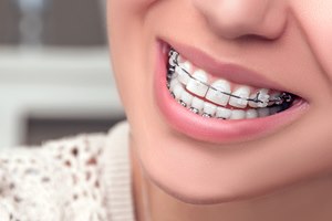 צילום: שאטרסטוק