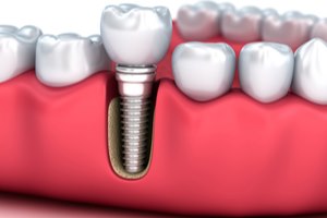 צילום: שאטרסטוק