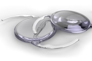 על קטרקט, פרסביופיה ומה שביניהם-תמונה