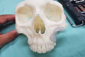 הדפסה בתלת-ממד כאמצעי הדמיה