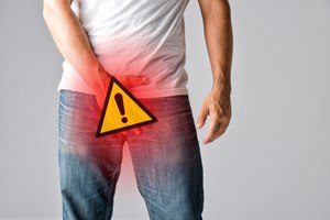 וריקוצלה: ניתוח לשיפור הפוריות-תמונה