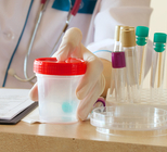 פענוח בדיקות דם ומעבדה - תמונה