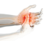 חיזוק חגורת הכתפיים - תמונת המחשה