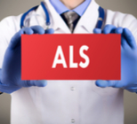 קפיצות שרירים - תמונת המחשה