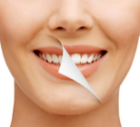 הלבנת שיניים WALKING - תמונת המחשה