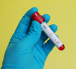 קרע בטחול - תמונת אווירה