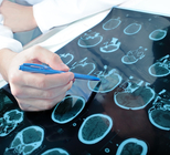 ניתוח נוירומה אקוסטית - תמונת אווירה