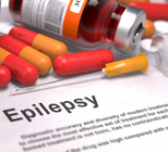 אפילפסיה אצל מבוגרים: כיצד לאבחן ולטפל?-תמונה