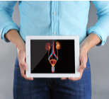 סרטן תאי מעבר - תמונת אווירה