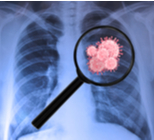 הנשמה מלאכותית מכנית - תמונת המחשה