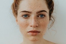 המדריך לכתמי שמש-תמונה