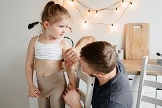 מולוסקום קונטגיוזום - תמונת אווירה