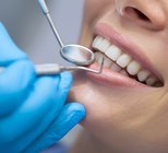 חיוך יפה הוא גם חיוך בריא-תמונה