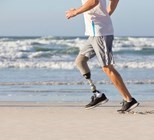 קטיעת רגל - תמונת המחשה