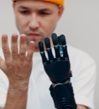 הכל על תותבות לגפיים עליונות-תמונה