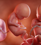 בירור כרומוזומלי גנטי בהריון תאומים-תמונה