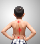 "עקמת אידיופטית פוגעת באיכות החיים"-תמונה