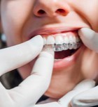 פלטה שקופה - תמונת המחשה