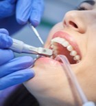 המרכז לשיקום הפה: כל מה שצריך כדי לחייך חיוך רחב -תמונה