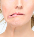 אקטרופיון בצוואר הרחם - תמונת אווירה