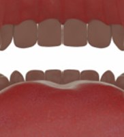 Froggy Mouth: מכשיר מהפכני לטיפול בתפקוד שרירי הפנים, השפתיים והלשון-תמונה