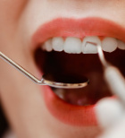 רפואת שיניים מהצד השני של המראה-תמונה