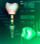 השתלות שיניים ממוחשבות: תשכחו מהכאב-תמונה