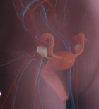 צלקת לאחר ניתוח קיסרי - תמונת אווירה