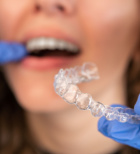 יישור שיניים למבוגרים