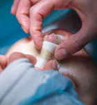 ניתוחי אף - מהצד הטיפולי ומהצד האסתטי-תמונה