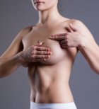 הסרת סרטן השד - תמונת המחשה