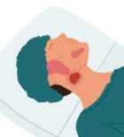 סובלים מנפיחות פתאומית בפנים בעת אכילה? ייתכן שבלוטות הרוק חסומות-תמונה