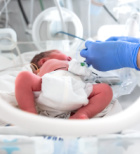 פג ולידה מוקדמת-תמונה