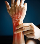 נוקשות בפרקים - תמונת המחשה