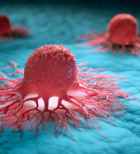 ראיון עם פרופ' רענן ברגר: "אבחון מוקדם ומהיר של סרטן יכול להציל חיים"-תמונה