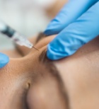 הניסיון בהזרקות מכריע בטיפולי אסתטיקה -תמונה