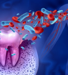 הקשר בין מחלות חניכיים למחלות לב-תמונה