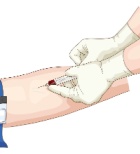 בדיקת דם חדשה לגילוי מוקדם של אלצהיימר בישראל-תמונה