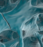 אוסטאופורוזיס - המחלה, תסמינים וטיפול-תמונה