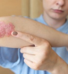 קושי בהליכה - תמונת אווירה