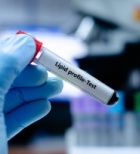 כולסטרול גבוה ושומנים בדם - תמונת אווירה