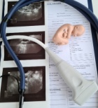 בדיקות לגילוי מומים בעובר: סקירת מערכות ודיקור מי שפיר – המדריך המלא-תמונה