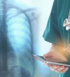 צילום חזה - תמונת המחשה