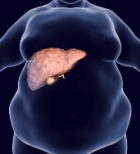 טיפול בכבד שומני: זריקת ההרזיה וויגובי מציגה תוצאות מרשימות -תמונה