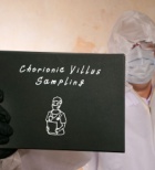 בדיקת סיסי שליה: המדריך המקיף לאבחון גנטי מוקדם בהריון-תמונה